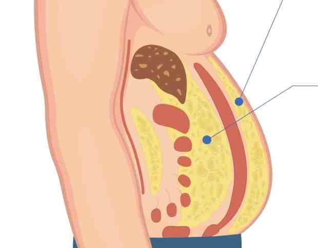 內臟脂肪測量