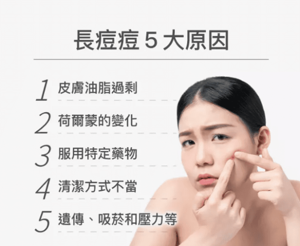 為什麼會長痘痘