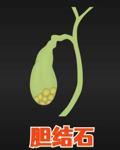 早餐吃什麼最好